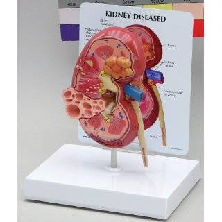 Human Kidney Anatomy Nephrology Urology Model #3250:  